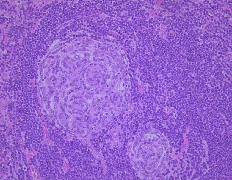 Pathology image