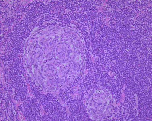Pathology image