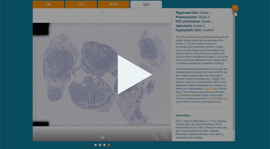 Screenshot of the Pathology tool video